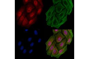 ABIN6258197 and ABIN6273942 staining Hela cells by IF/ICC. (GPR88 抗体  (Internal Region))