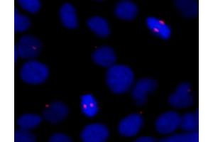 anti-CDK5 Regulatory Subunit Associated Protein 2 (CDK5RAP2) (C-Term) antibody