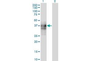 Western Blot analysis of SPARC expression in transfected 293T cell line by SPARC monoclonal antibody (M04A), clone 1A2. (SPARC 抗体  (AA 1-303))
