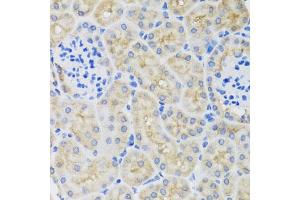 Immunohistochemistry of paraffin-embedded mouse kidney using SULT1A1 antibody (ABIN5970776) at dilution of 1/100 (40x lens). (SULT1A1 抗体)