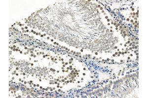 Phospho-Hsp90 alpha (Thr5/Thr7) Antibody at 1/100 staining Rat testis tissue by IHC-P.