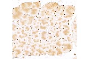 Immunohistochemistry (Paraffin-embedded Sections) (IHC (p)) image for anti-Ubiquitin Specific Peptidase 24 (USP24) antibody (ABIN7076111)