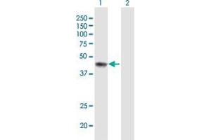 Western Blot analysis of ERCC8 expression in transfected 293T cell line by ERCC8 MaxPab polyclonal antibody. (ERCC8 抗体  (AA 1-396))
