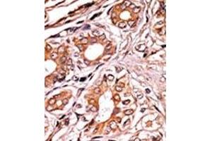 Image no. 2 for anti-Retinoblastoma 1 (RB1) (pSer249) antibody (ABIN358210) (Retinoblastoma 1 抗体  (pSer249))