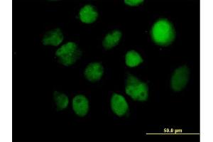 Immunofluorescence of purified MaxPab antibody to ITPK1 on HeLa cell. (ITPK1 抗体  (AA 1-314))