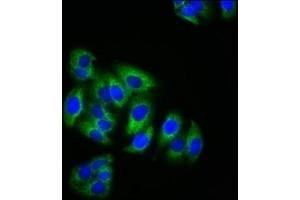 Immunofluorescence staining of HepG2 cells with ABIN7157699 at 1:200, counter-stained with DAPI. (KRIT1 抗体  (AA 471-585))