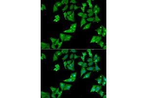 Immunofluorescence analysis of HeLa cells using AGA antibody (ABIN6294189). (AGA 抗体)