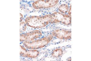 Immunohistochemistry (IHC) image for anti-Choline Dehydrogenase (CHDH) (AA 245-594) antibody (ABIN7266341)