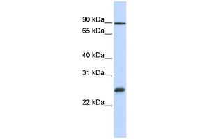 WB Suggested Anti-RBPMS Antibody Titration:  0.