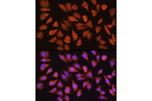 Immunofluorescence analysis of L929 cells using IMPDH1 Rabbit pAb (ABIN6133190, ABIN6142433, ABIN6142434 and ABIN6225023) at dilution of 1:100 (40x lens). (IMPDH1 抗体  (AA 434-563))