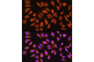 Immunofluorescence analysis of L929 cells using IMPDH1 Rabbit pAb (ABIN6133190, ABIN6142433, ABIN6142434 and ABIN6225023) at dilution of 1:100 (40x lens). (IMPDH1 抗体  (AA 434-563))