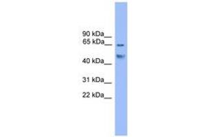 Image no. 1 for anti-Runt-Related Transcription Factor 2 (RUNX2) (C-Term) antibody (ABIN6745999) (RUNX2 抗体  (C-Term))