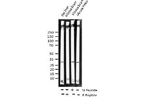 Western blot analysis of Phospho-SNAI1 (Ser246) expression in various lysates (SNAIL 抗体  (pSer246))
