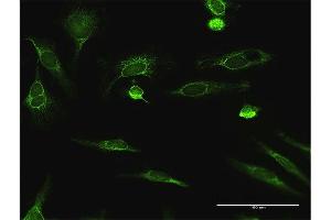 Immunofluorescence (IF) image for anti-Enoyl CoA Hydratase, Short Chain, 1, Mitochondrial (ECHS1) (AA 1-290) antibody (ABIN515147)