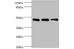 Western blot All lanes: SUGCT antibody at 16 μg/mL Lane 1: Mouse skeletal muscle tissue Lane 2: Mouse liver tissue Lane 3: Mouse kidney tissue Secondary Goat polyclonal to rabbit IgG at 1/10000 dilution Predicted band size: 49, 48, 52, 44 kDa Observed band size: 42 kDa (SUGCT 抗体  (AA 1-250))
