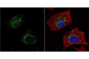 ICC/IF Image ACADM antibody detects ACADM protein at mitochondria by immunofluorescent analysis. (Medium-Chain Specific Acyl-CoA Dehydrogenase, Mitochondrial (Center) 抗体)