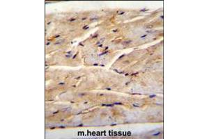 RMD1 Antibody immunohistochemistry analysis in formalin fixed and paraffin embedded mouse heart tissue followed by peroxidase conjugation of the secondary antibody and DAB staining. (RMD1 抗体  (N-Term))