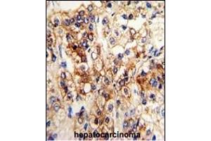 Immunohistochemistry (Paraffin-embedded Sections) (IHC (p)) image for anti-Cytochrome P450, Family 2, Subfamily J, Polypeptide 2 (CYP2J2) (AA 96-124), (N-Term) antibody (ABIN652340)