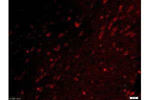 Paraformaldehyde-fixed, paraffin embedded rat brain tissue, Antigen retrieval by boiling in sodium citrate buffer(pH6) for 15min, Block endogenous peroxidase by 3% hydrogen peroxide for 30 minutes, Blocking buffer (normal goat serum) at 37°C for 20min, Antibody incubation with Rabbit Anti-UBE2Q1 Polyclonal Antibody, Unconjugated  at 1:500 overnight at 4°C, followed by a conjugated secondary and DAPI staining (UBE2Q1 抗体  (AA 321-422))