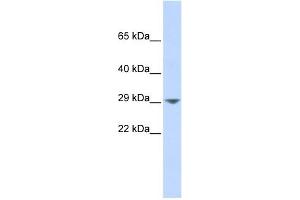 KCNN2 antibody used at 1 ug/ml to detect target protein. (KCNN2 抗体  (Middle Region))