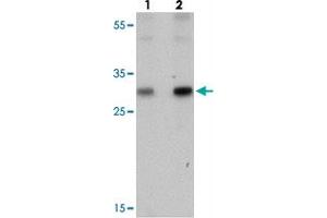 Western blot analysis of PTRF in human spleen tissue with PTRF polyclonal antibody  at (lane 1) 0. (PTRF 抗体  (C-Term))