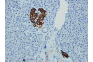 Immunohistochemistry (IHC) image for anti-Synaptophysin (SYP) (AA 293-310), (C-Term) antibody (ABIN7598775) (Synaptophysin 抗体  (C-Term))