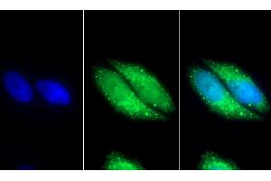 Detection of MDH2 in Human HepG2 cell using Polyclonal Antibody to Malate Dehydrogenase 2 (MDH2) (MDH2 抗体  (AA 25-338))