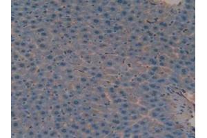 Figure. (Versican 抗体  (AA 3058-3299))