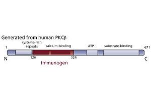 Image no. 2 for anti-Protein Kinase C, beta (PRKCB) (AA 126-324) antibody (ABIN967769) (PKC beta 抗体  (AA 126-324))