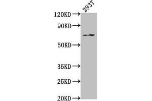 Western Blot Positive WB detected in: 293T whole cell lysate All lanes: PXN antibody at 1:2000 Secondary Goat polyclonal to rabbit IgG at 1/50000 dilution Predicted band size: 65, 61, 67, 47 kDa Observed band size: 65 kDa