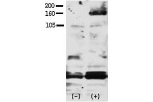 Image no. 1 for anti-V-Erb-A erythroblastic Leukemia Viral Oncogene Homolog 4 (Avian) (ERBB4) (pTyr1188) antibody (ABIN358140) (ERBB4 抗体  (pTyr1188))