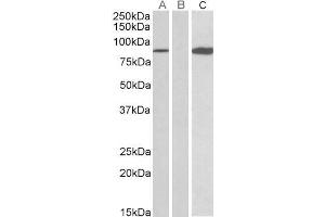 HEK293 lysate (10ug protein in RIPA buffer) overexpressing Human STAT4 (RC206892) with C-terminal MYC tag probed with ABIN571127 (0. (STAT4 抗体  (AA 613-627))