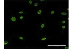 Immunofluorescence of monoclonal antibody to U2AF2 on HeLa cell.