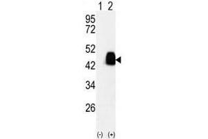 Image no. 2 for anti-Pyruvate Dehydrogenase Complex, Component X (PDHX) antibody (ABIN357415)