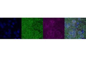Immunohistochemistry (IHC) image for anti-Insulin-Like Growth Factor Binding Protein 6 (IGFBP6) antibody (ABIN7456078) (IGFBP6 抗体)