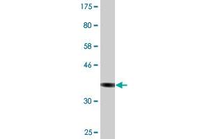 Western Blot detection against Immunogen (36. (CSAD 抗体  (AA 1-98))