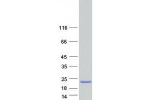 Western Blotting (WB) image for Sterol Carrier Protein 2 (SCP2) (Transcript Variant 4) protein (Myc-DYKDDDDK Tag) (ABIN2731506)