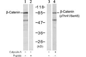 Image no. 1 for anti-Catenin (Cadherin-Associated Protein), beta 1, 88kDa (CTNNB1) (pSer45), (pThr41) antibody (ABIN196814) (CTNNB1 抗体  (pSer45, pThr41))