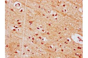 IHC image of ABIN7154356 diluted at 1:500 and staining in paraffin-embedded human brain tissue performed on a Leica BondTM system. (PIGT 抗体  (AA 402-562))