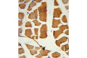 Immunohistochemistry (IHC) image for anti-BMI1 Polycomb Ring Finger Oncogene (BMI1) antibody (ABIN3001536) (BMI1 抗体)