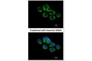 ICC/IF Image Immunofluorescence analysis of methanol-fixed A431, using TRHR, antibody at 1:500 dilution. (TRHR 抗体  (C-Term))