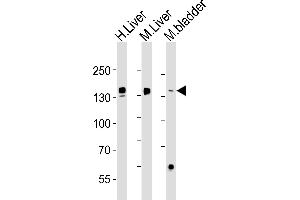 Western blot analysis of lysates from human Liver, mouse Liver, mouse bladder tissue (from left to right), using FGA Antibody (N-term) (ABIN1538750 and ABIN2843856). (FGA 抗体  (N-Term))
