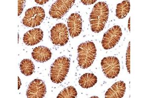 IHC testing of human stomach stained with MUC5AC antibody (45M1). (MUC5AC 抗体)