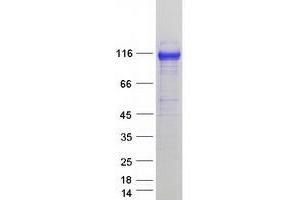 Western Blotting (WB) image for Adaptor-Related Protein Complex 1, beta 1 Subunit (AP1B1) (Transcript Variant 1) protein (Myc-DYKDDDDK Tag) (ABIN2714765)