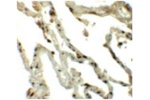 Immunohistochemistry of Translin in Human lung tissue with Translin antibody at 5 µg/ml. (Translin 抗体  (C-Term))