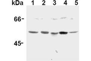 Western Blotting (WB) image for anti-Caspase 12 (Gene/pseudogene) (CASP12) (AA 95-318), (N-Term) antibody (ABIN567795)