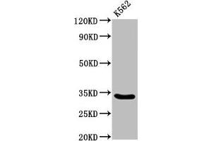 Western Blot Positive WB detected in: K562 whole cell lysate All lanes: PEX26 antibody at 3. (PEX26 抗体  (AA 1-159))