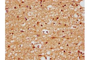 IHC image of ABIN7165514 diluted at 1:200 and staining in paraffin-embedded human brain tissue performed on a Leica BondTM system. (BRINP2 抗体  (AA 98-199))