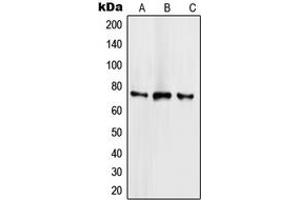 Western blot analysis of SCML2 expression in HeLa (A), NCIH460 (B), Jurkat (C) whole cell lysates. (SCML2 抗体  (Center))