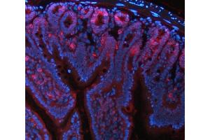IF analysis of NKCC1/SLC12A2 using anti-NKCC1/SLC12A2 antibody (ABIN7602601).